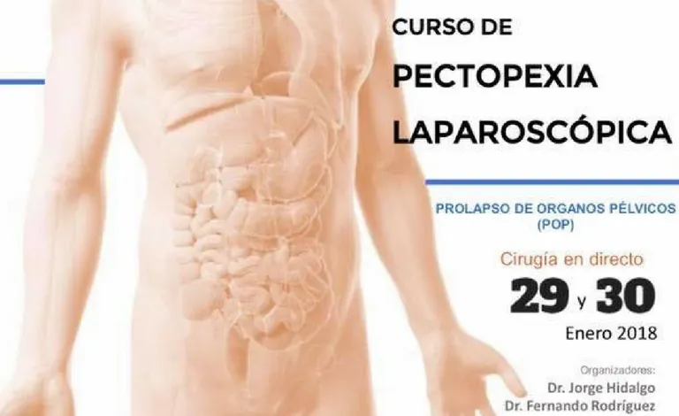 Curso de pectopexia laparoscópica para el prolapso de órganos pélvicos