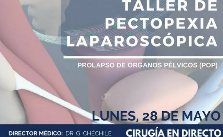 Taller práctico de pectopexia laparoscópica para especialistas